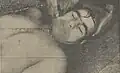 جنازه غلامرضا تختی پس از کالبدشکافی