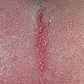 خطوط منحصر به فرد بر روی زبان
