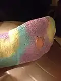 جوراب با سوراخ در آن.