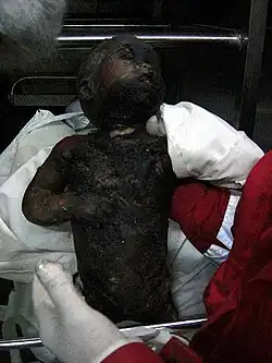 A Palestinian baby killed by the IDF