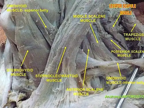 ماهیچه بالابرنده کتف