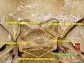 Base of skull - dorsum sellae
