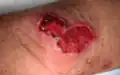 سنگال