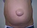 ۳