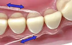 File:Floss4.jpg