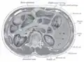 Transverse section through the middle of the first lumbar vertebra.