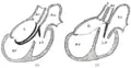 Diagrams to illustrate the transformation of the bulbus cordis. Ao. Truncus arteriosus. Au. Atrium. B. Bulbus cordis. RV. بطن (قلب). LV. بطن (قلب). P. سرخرگ ریوی.
