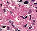 Histoplasma. پاس diastase لکه.