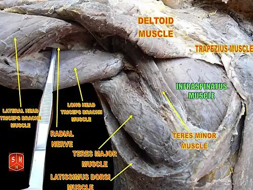 ماهیچه زیرخاری