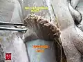 فاسیای عرضی