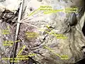 Facial artery.Deep dissection.Lateral view.