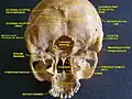 Mastoid part of the temporal bone.Base of skull.