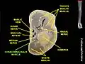 Coracobrachialis muscle (shown in green text). دید بالایی-پایینی of arm.