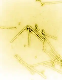 Electron micrograph of TMV particles negative stained to enhance visibility at 160,000× magnification