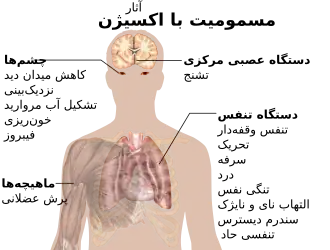 A diagraph showing a man torso and listing symptoms of oxygen toxicity: Eyes – visual field loss, near)sightedness, cataract formation, bleeding, fibrosis; Head – seizures; Muscles – twitching; Respiratory system – jerky breathing, irritation, coughing, pain, shortness of breath, tracheobronchitis, acute respiratory distress syndrome.