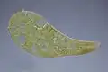 Stentor polymorphus به همراه جلبک همزیست