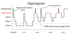 Hypnogram showing sleep cycles from midnight to morning.