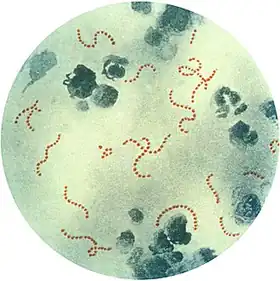 Streptococcus pyogenes